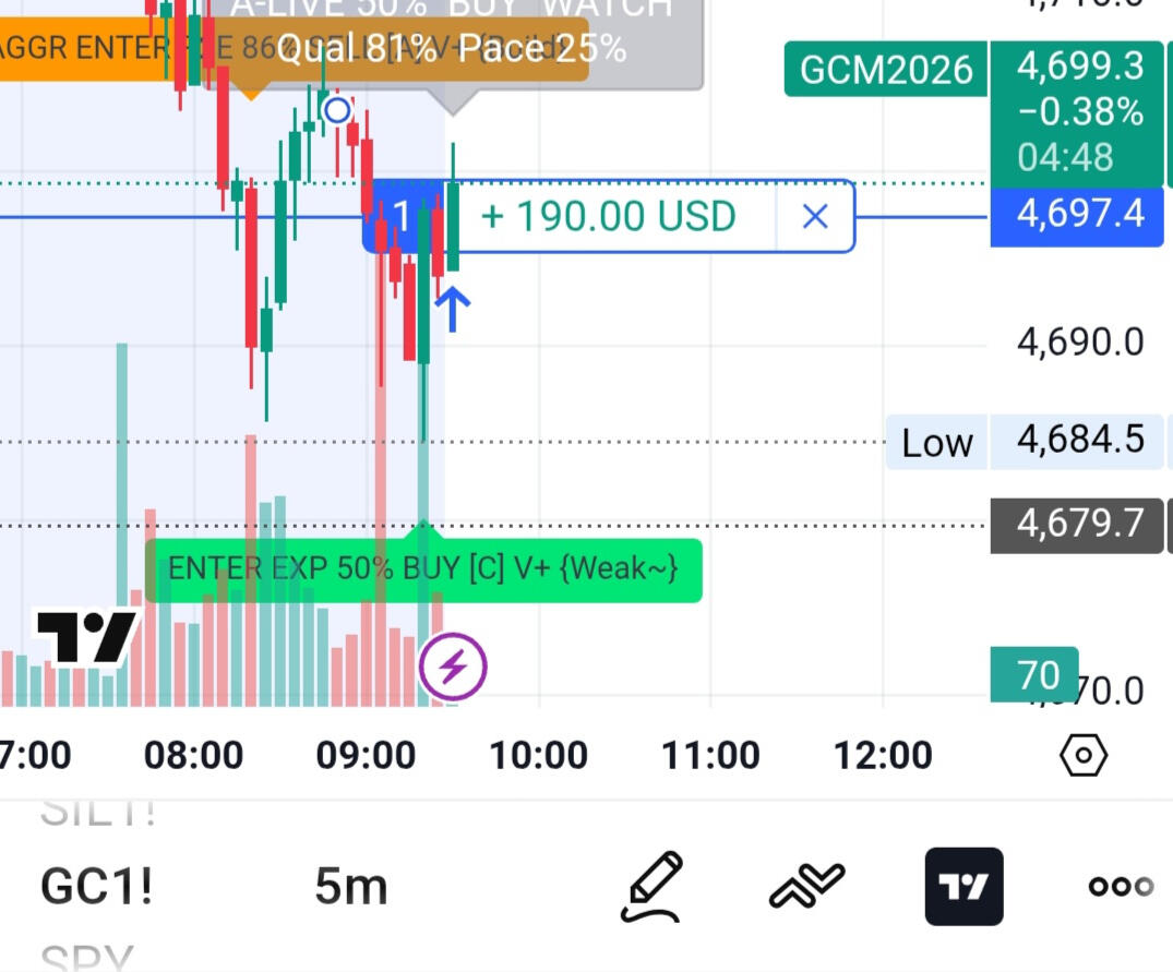 $190 on Gold in minutes! Real Trades Real Results!
